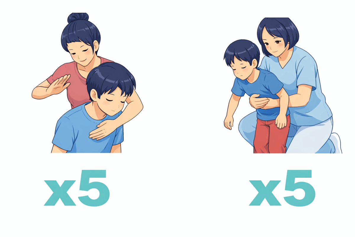 Maniobra de desobstrucción para niños mayores de 1 año: golpes en espalda y maniobra de Heimlich