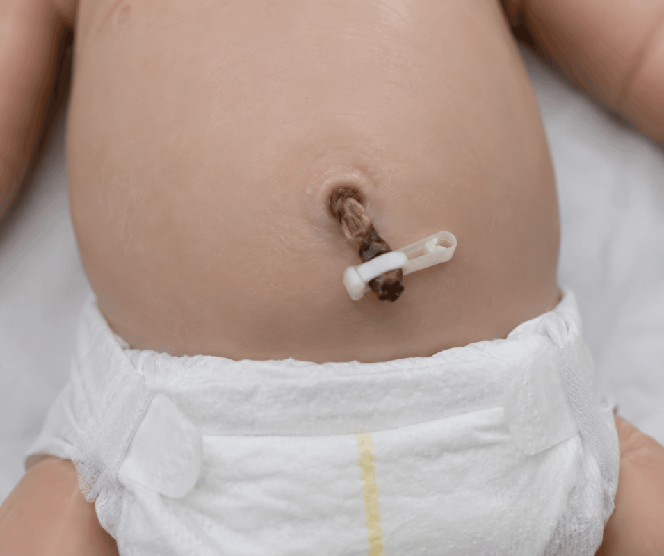 Cuidados del recién nacido: guía para los primeros días Cordón umbilical de un recién nacido con la pinza puesta, secándose por encima del pañal